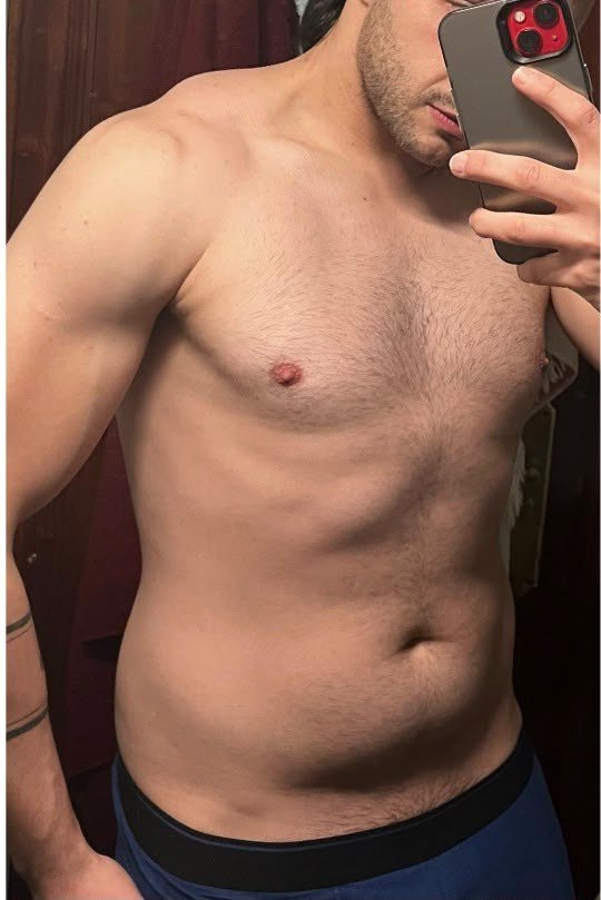 Antes del proceso, caso 05